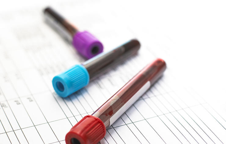 how to diagnose Leukemia how to diagnose Leukemia