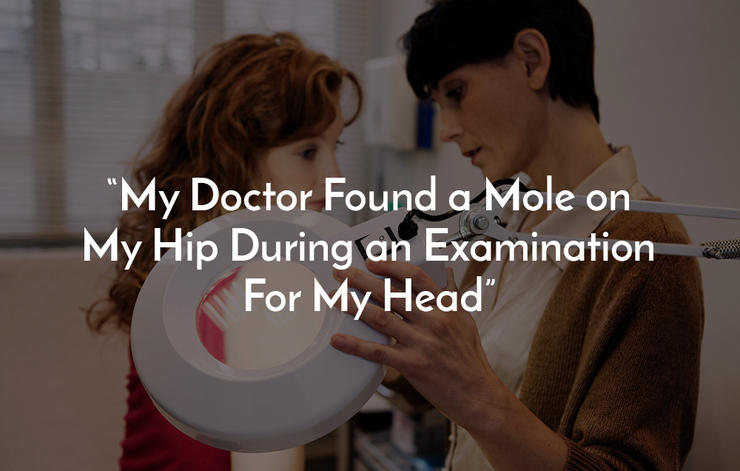 My Doctor Found a Mole on My Hip During an Examination For My Head My Doctor Found a Mole on My Hip During an Examination For My Head