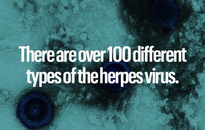 There are over 100 different types of the herpes virus